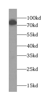PLOD2-Specific antibody|PLOD2抗