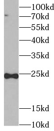TNFSF12 antibody|TNFSF12抗体