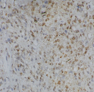 CHCHD6 antibody|CHCHD6抗体