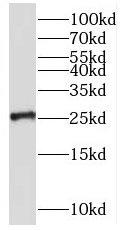 RNF151 antibody|RNF151抗体