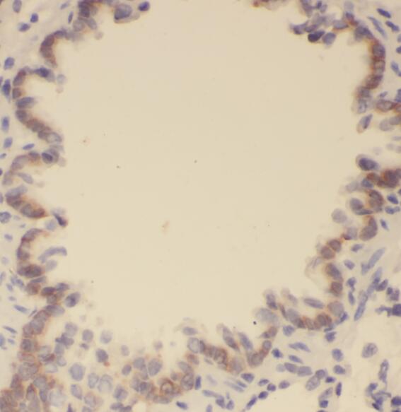 PLAAT4 antibody|PLAAT4抗体