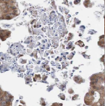 WFDC2 antibody|WFDC2抗体 FNab038