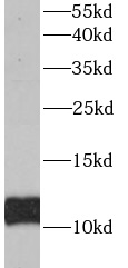 ACYP1 antibody|ACYP1抗体