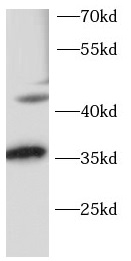 OTX2 antibody|OTX2抗体 FNab10083