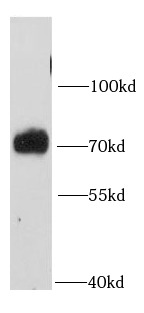 PTPN11 antibody|PTPN11抗体 FNab0