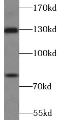 AMOT antibody|AMOT抗体 FNab09852
