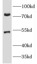 KCNA3 antibody|KCNA3抗体
