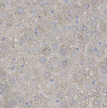 ANGPTL8 antibody|ANGPTL8抗体 FNa