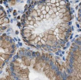 CCKAR-specific antibody|CCKAR抗