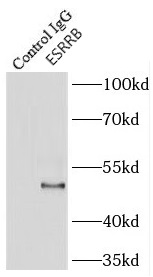 DBN1 antibody|DBN1抗体 FNab02535