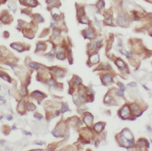 DUSP22 antibody|DUSP22抗体 FNab0