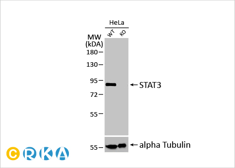 文献速递：细胞外基质硬化与睾丸老化及睾酮水平下降相关