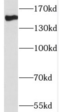 THOC2 antibody|THOC2抗体