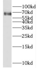 FZD7 antibody|FZD7抗体