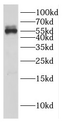 DEPTOR antibody|DEPTOR抗体 FNab0