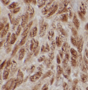 C9 antibody|C9抗体 FNab10108