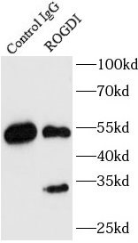 RAB8A antibody|RAB8A抗体