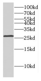 DLX1 antibody|DLX1抗体