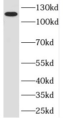 POP1 antibody|POP1抗体