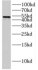 IRF8 antibody|IRF8抗体 FNab04395