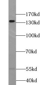 TRPS1 antibody|TRPS1抗体 FNab090