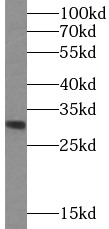 ASRGL1 antibody|ASRGL1抗体