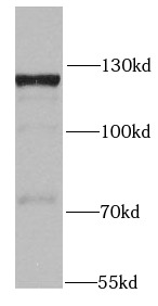 MTREX antibody|MTREX抗体