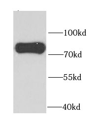 PAK6 antibody|PAK6抗体