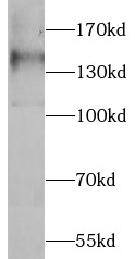 FLT1 antibody|FLT1抗体