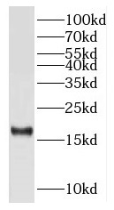 RPS15 antibody|RPS15抗体