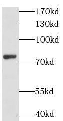 LSS antibody|LSS抗体 FNab04881