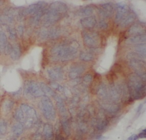 HDAC10 antibody|HDAC10抗体 FNab1