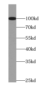MCPH1 antibody|MCPH1抗体