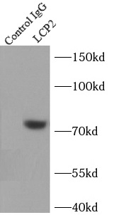 SYCP3 antibody|SYCP3抗体