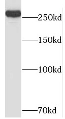 NIPBL antibody|NIPBL抗体