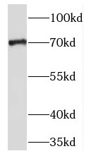 TM9SF4 antibody|TM9SF4抗体