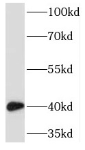 TMOD2 antibody|TMOD2抗体