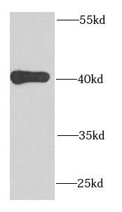 MRPS22 antibody|MRPS22抗体