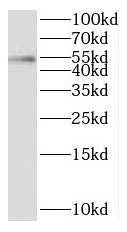 PPM1B antibody|PPM1B抗体