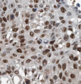 SMARCA4 antibody|SMARCA4抗体 FNa