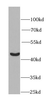 PGK1 antibody|PGK1抗体