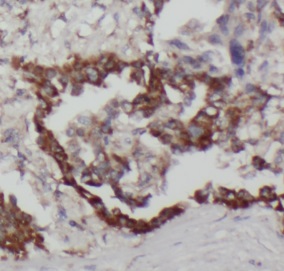 NPRL2 antibody|NPRL2抗体