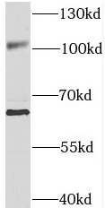 SNX25 antibody|SNX25抗体