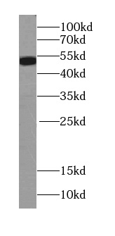RPS6KB2 antibody|RPS6KB2抗体 FNa