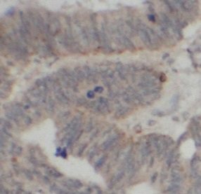 MAP3K1 antibody|MAP3K1抗体