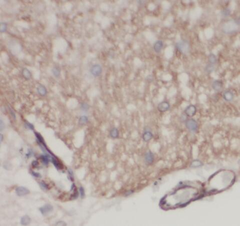 SNUPN antibody|SNUPN抗体