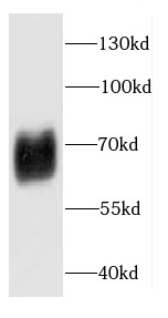 CAMK4 antibody|CAMK4抗体