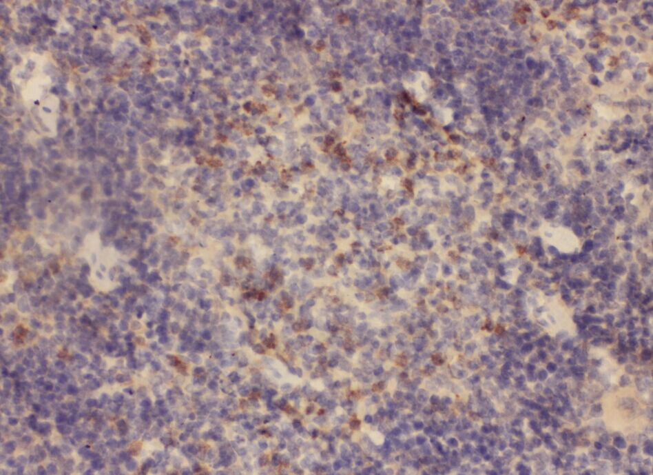 WAS antibody|WAS抗体