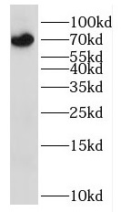 IL3RA antibody|IL3RA抗体