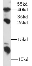 S100A8 antibody|S100A8抗体 FNab0